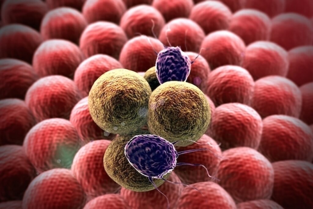 animación de células Neoplasias